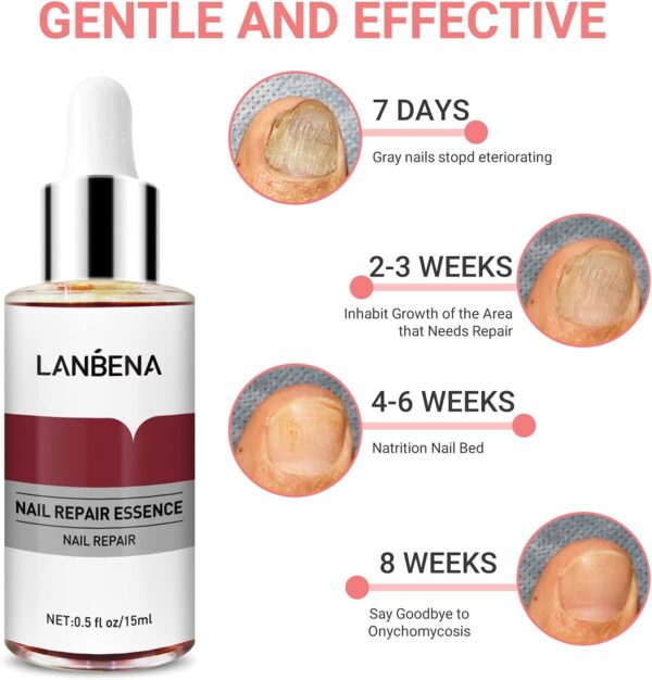 LANBENA Nails Repair, Nail Treatment Nail Care Serum Protect Nail - Image 4