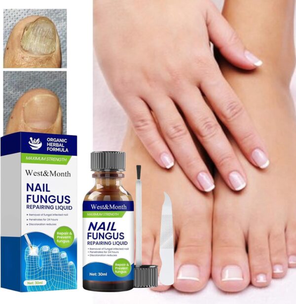 AXIYIBZI Nail Repair, Fingernail and Toenail Repair - Image 4